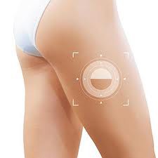 Alimentos que combatem a celulite